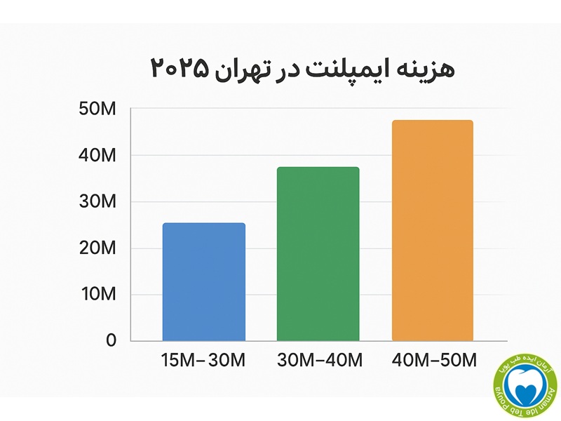 نمودار هزینه ایمپلنت دندان در تهران ۲۰۲۵