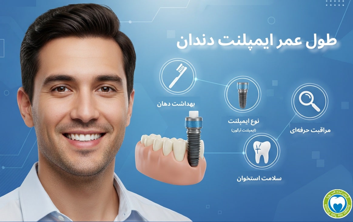اینفوگرافیک طول عمر ایمپلنت دندان با عوامل موثر